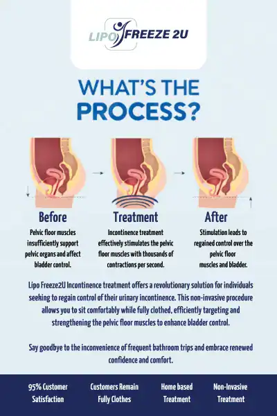 Diagram of how incontinence treatment Oldham works.
