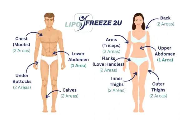 Areas you can have fat freezing treatment Oldham